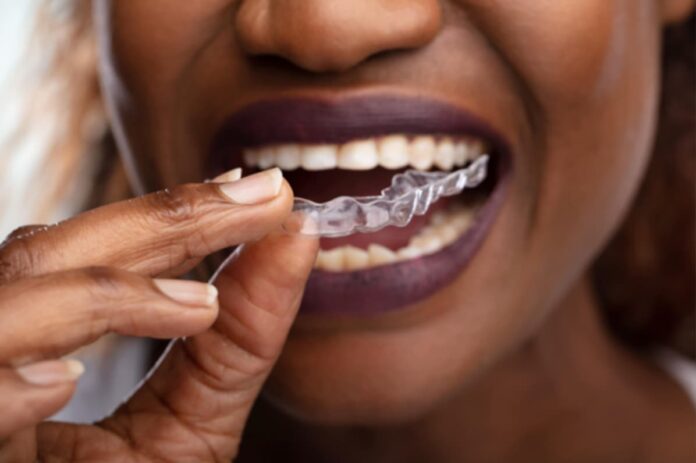 Invisible Braces Primecare Dental